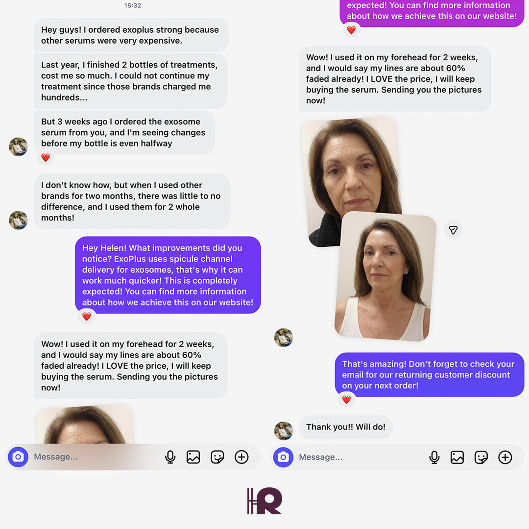 Helenor ExoPlus® Serum