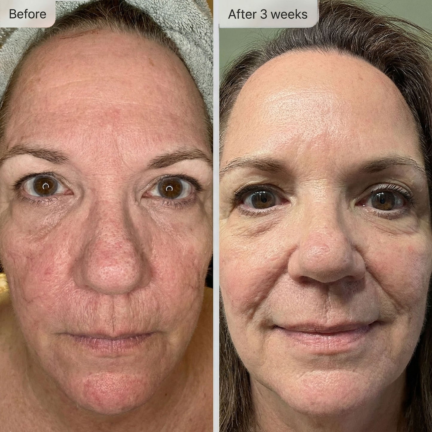 Helenor ExoPlus® Serum