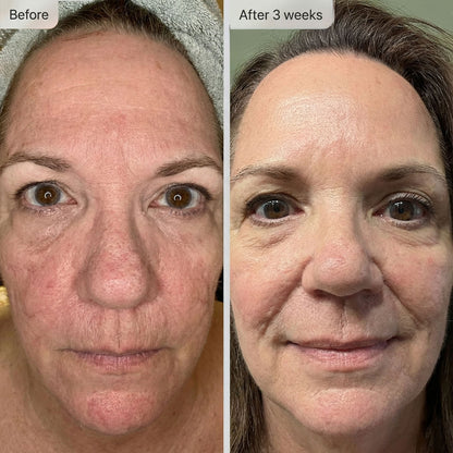 Helenor ExoPlus® Serum