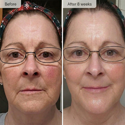 Helenor ExoPlus® Serum