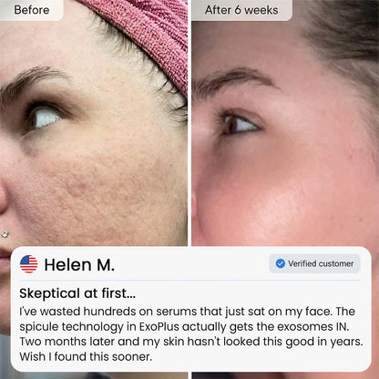 Helenor ExoPlus® Serum